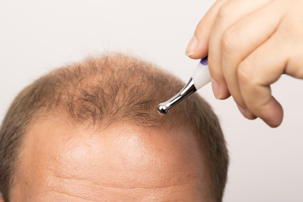 man controls hair loss
