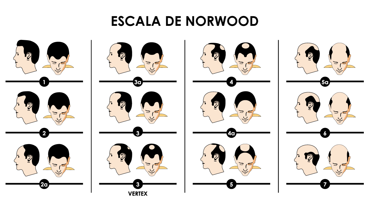 Escala de Norwood