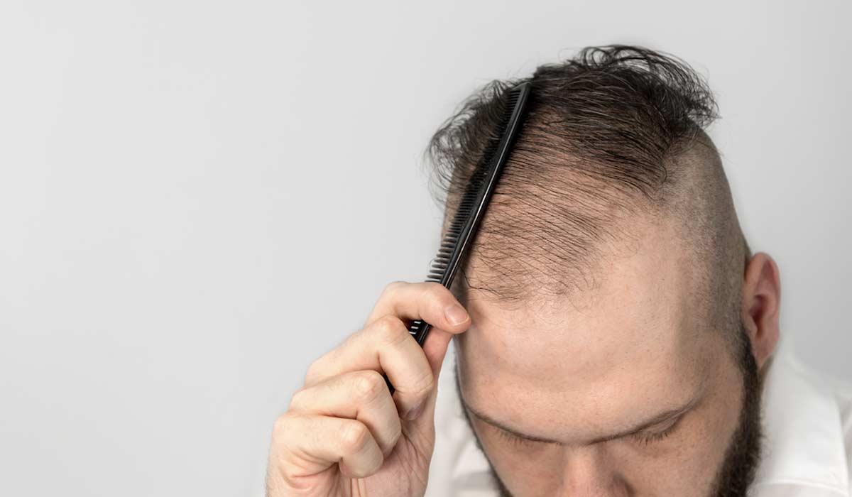 Efectos Secundarios del Finasteride